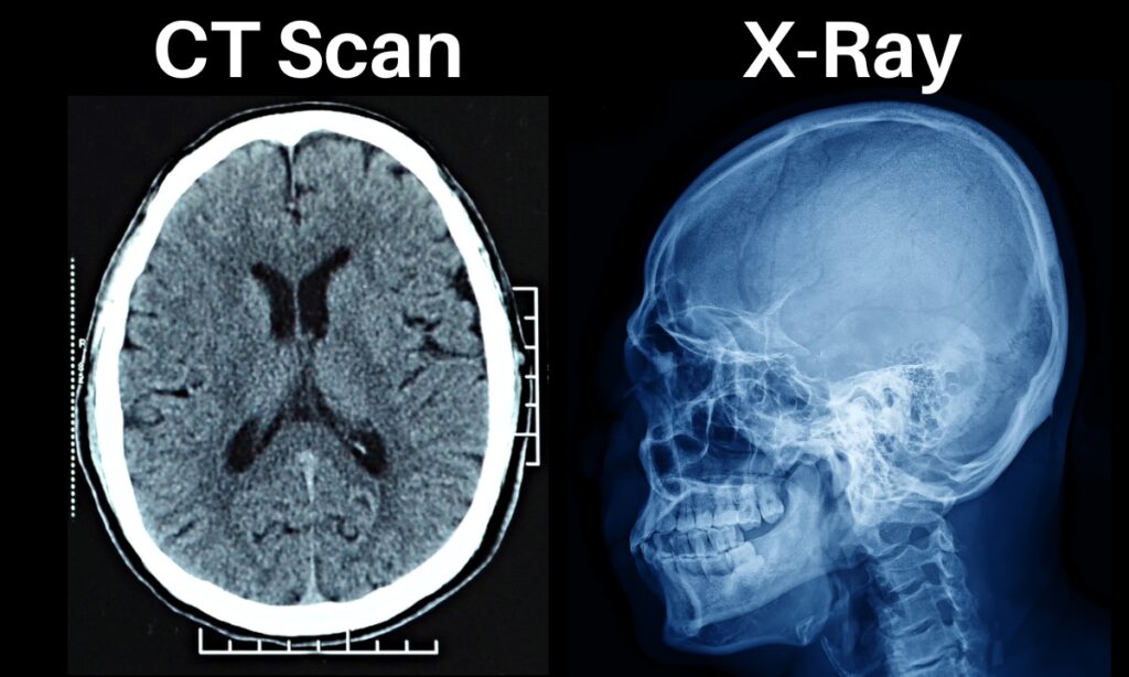 CT Scan