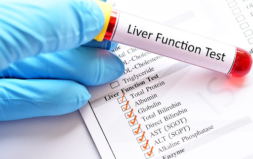 liver function test