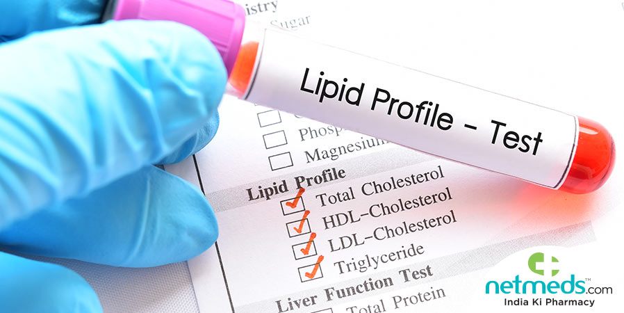 Lipid Profile Test