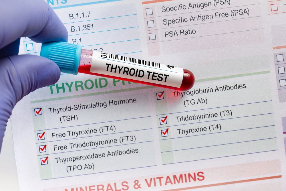 Thyroid Function Test