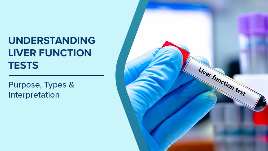 understanding liver function tests 1 681e46798d